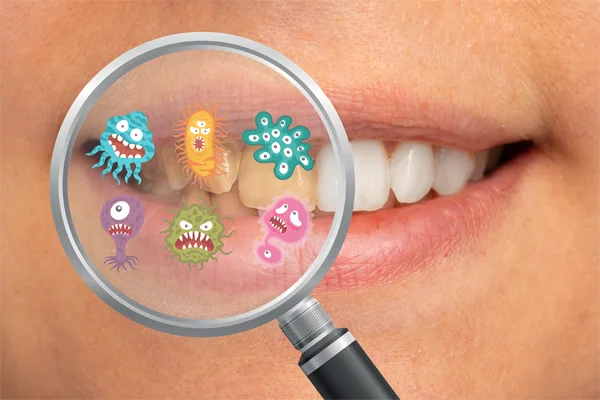 Gum Health
