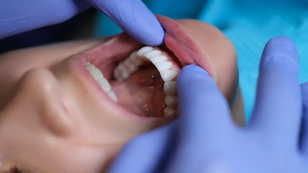 Gum Disease Receding Gums Treatment in Montana