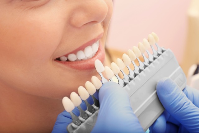 Porcelain Veneers
